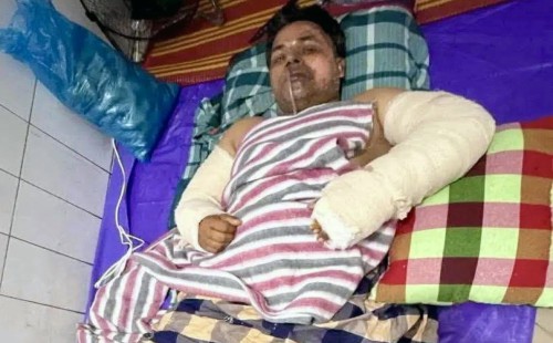 ইউটিউব দেখে অকটেন তৈরির চেষ্টা   বিস্ফোরণে দগ্ধ হয়ে প্রাণ গেল ব্যবসায়ীর